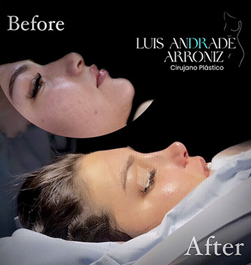 Resultado de procedimiento anterior 6